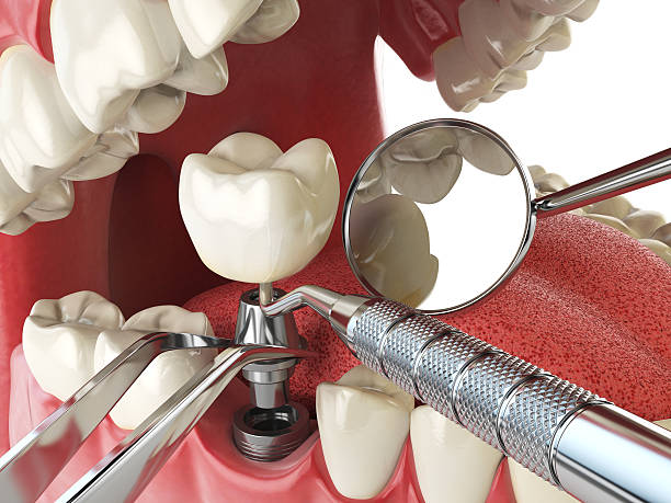 Best Knocked-Out Tooth Emergency  in Oak Hills, PA